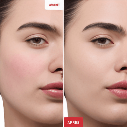 CC Red Crème anti - rougeurs - Eydn